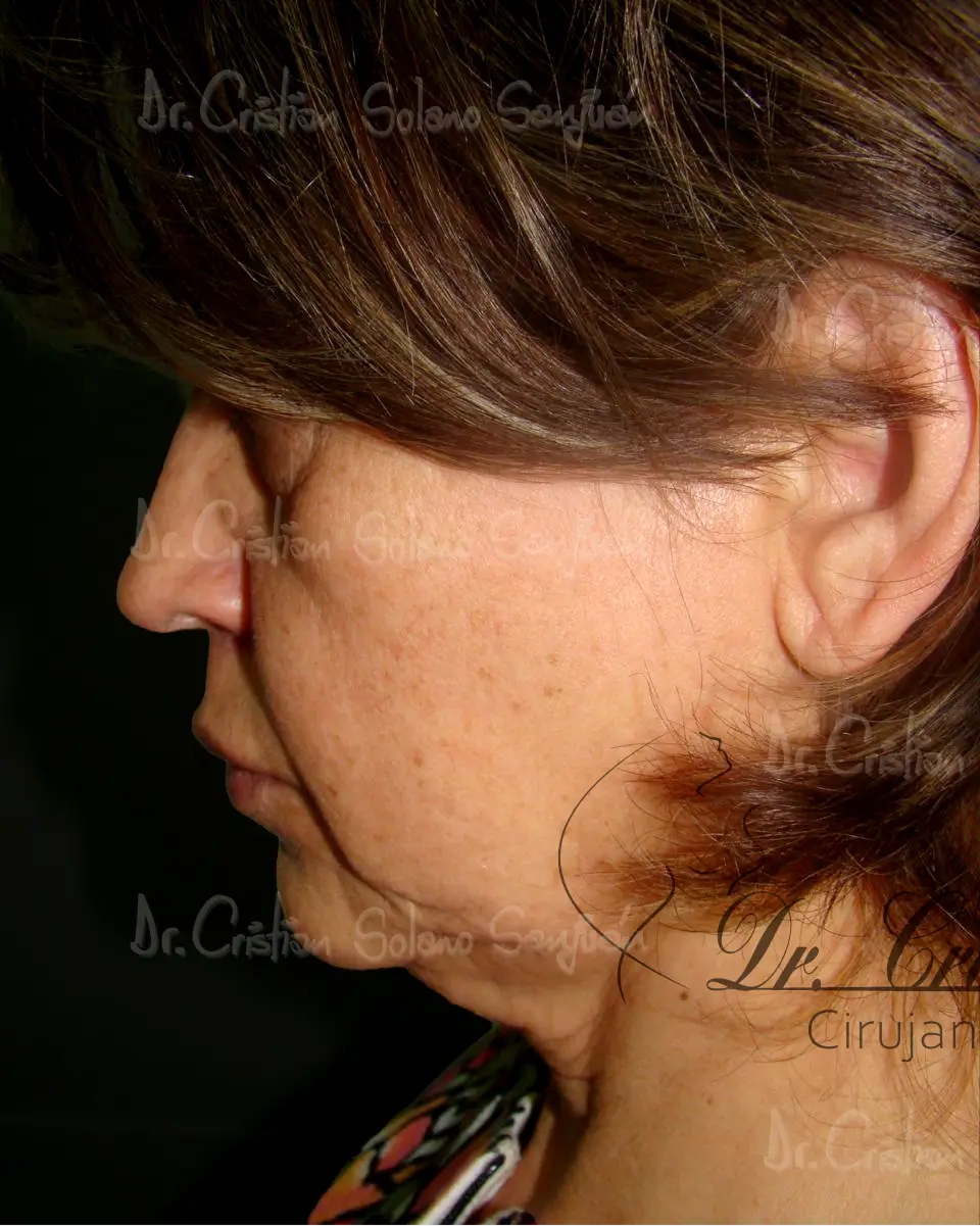 dr-cristian-solano-servicio-cirugia-de-cuello